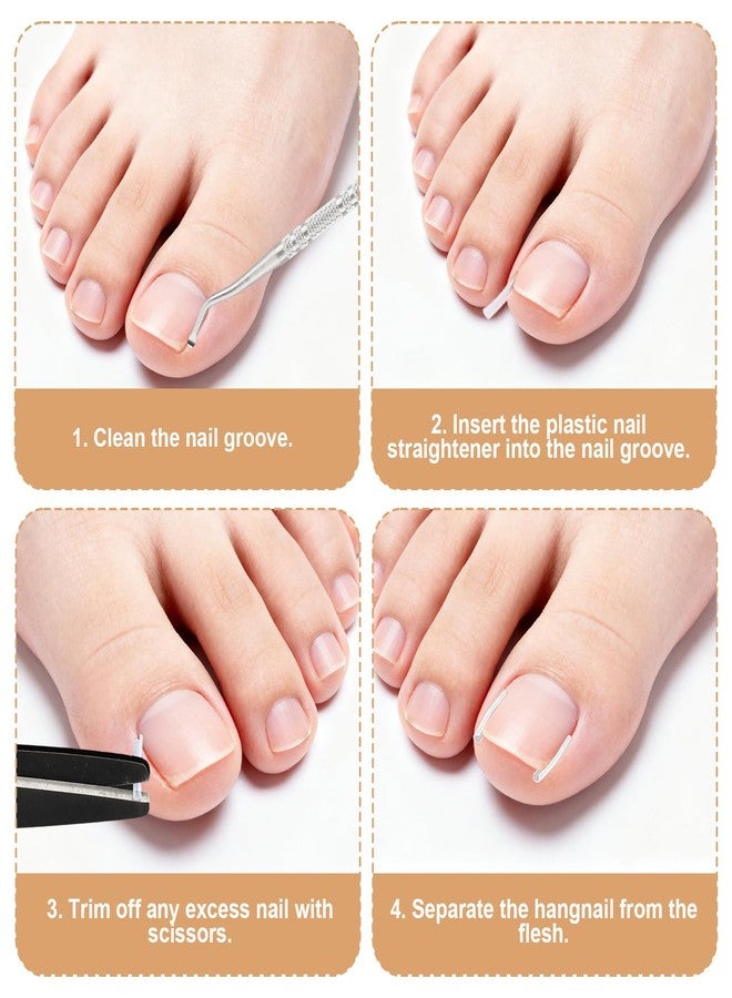 Penitue 16pcs Ingrown Toenail Straighten Set with Breathable Ingrowing Toenail Strips, Professional Pedicure Nail Tool Removal Kit with Clippers File Lifter Cuticle Tools for Men Women Toenails Maintenance - Image 5